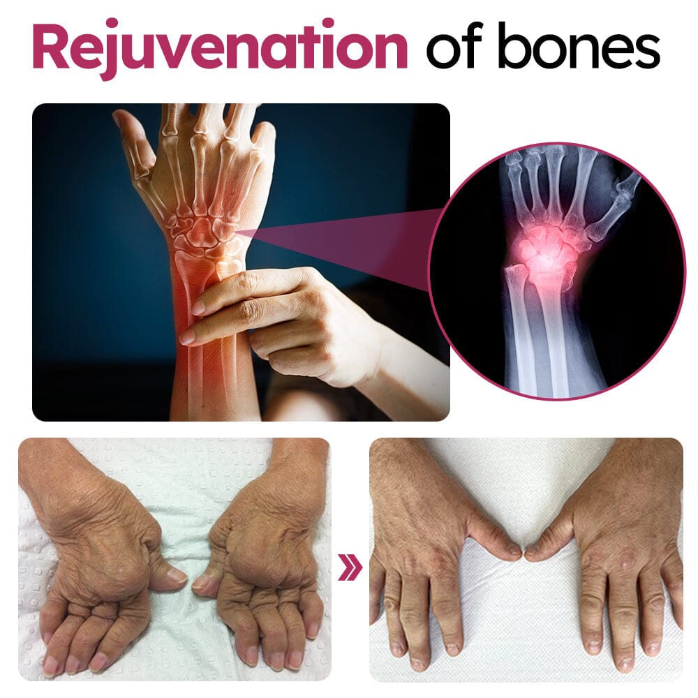 Slimoly™ Advanced Joint & Bone Renewal Cream