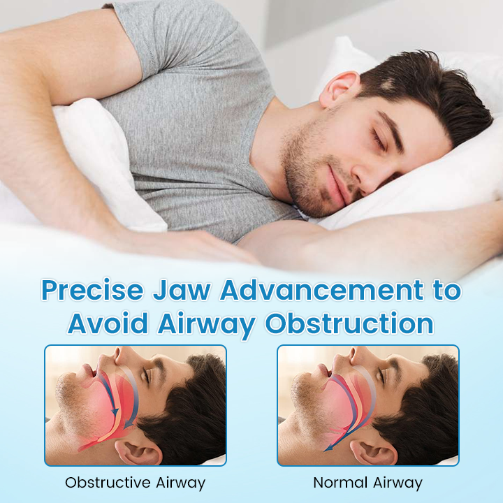 ✨QIAWI™ Anti-Snoring & Teeth Grinding Mouthpiece