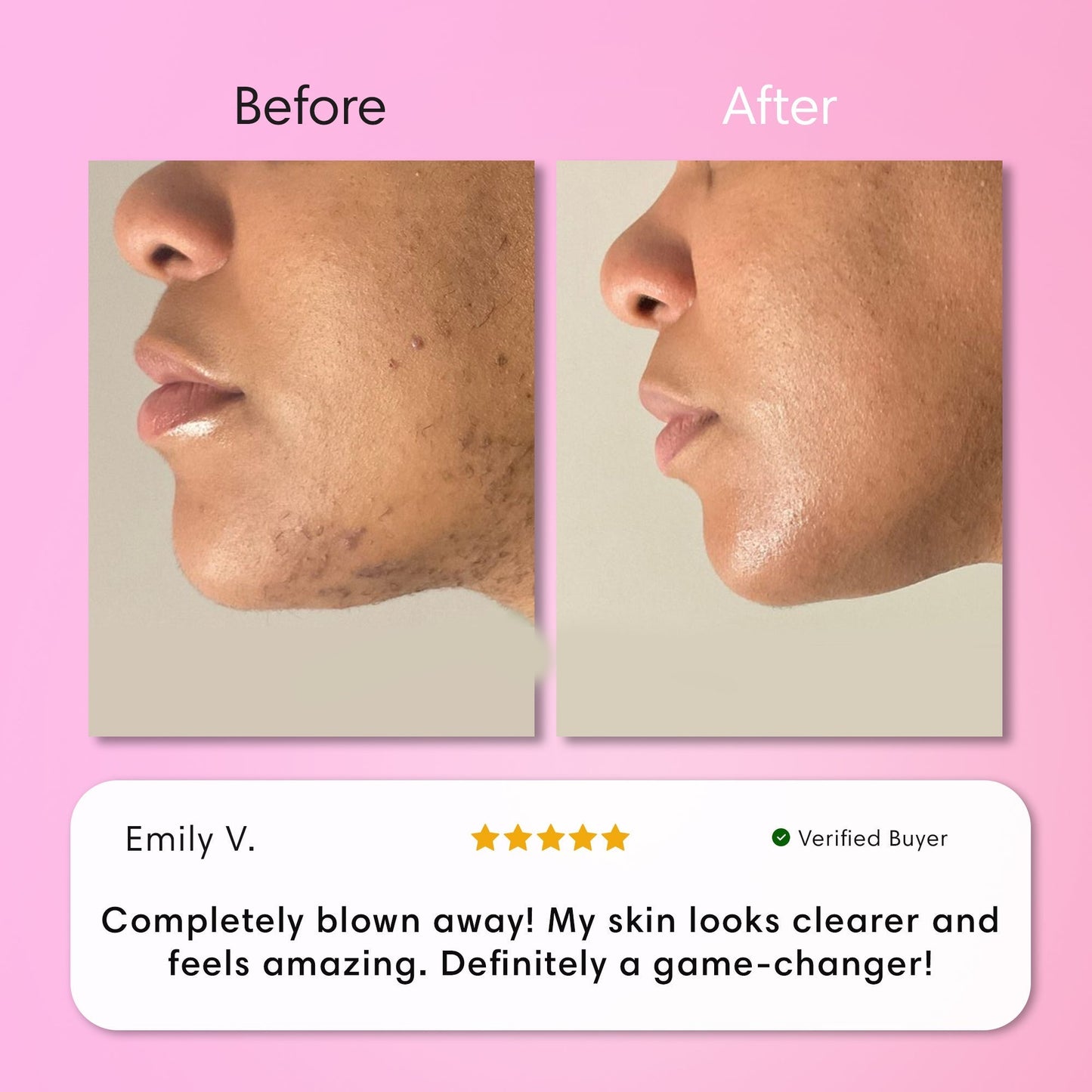 ✨[Official Store]✨                  𝑨𝑸𝑨™ 𝑰𝒏𝒔𝒕𝒂𝒏𝒕 𝑯𝒂𝒊𝒓 𝑹𝒆𝒎𝒐𝒗𝒂𝒍 𝑲𝒊𝒕