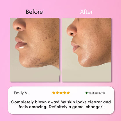 ✨[Official Store]✨                  𝑨𝑸𝑨™ 𝑰𝒏𝒔𝒕𝒂𝒏𝒕 𝑯𝒂𝒊𝒓 𝑹𝒆𝒎𝒐𝒗𝒂𝒍 𝑲𝒊𝒕