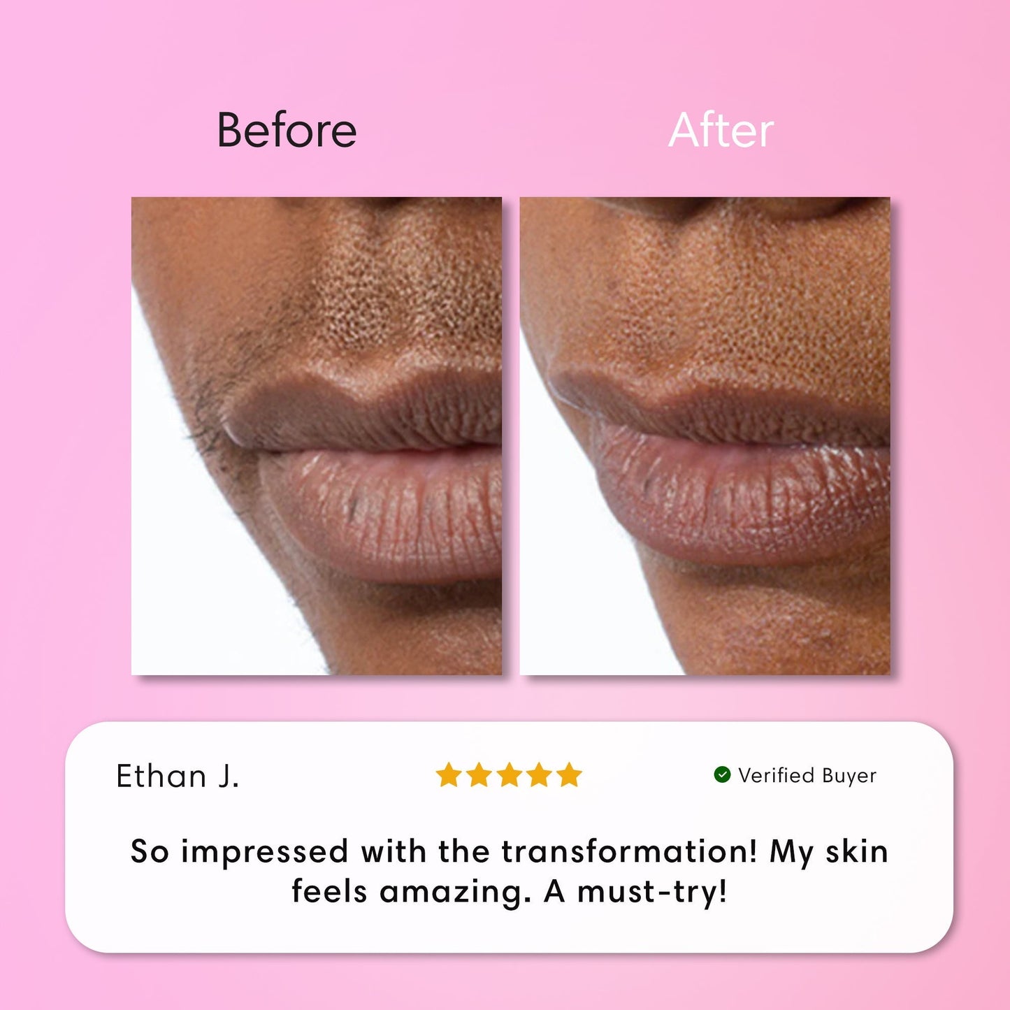 ✨[Official Store]✨                  𝑨𝑸𝑨™ 𝑰𝒏𝒔𝒕𝒂𝒏𝒕 𝑯𝒂𝒊𝒓 𝑹𝒆𝒎𝒐𝒗𝒂𝒍 𝑲𝒊𝒕