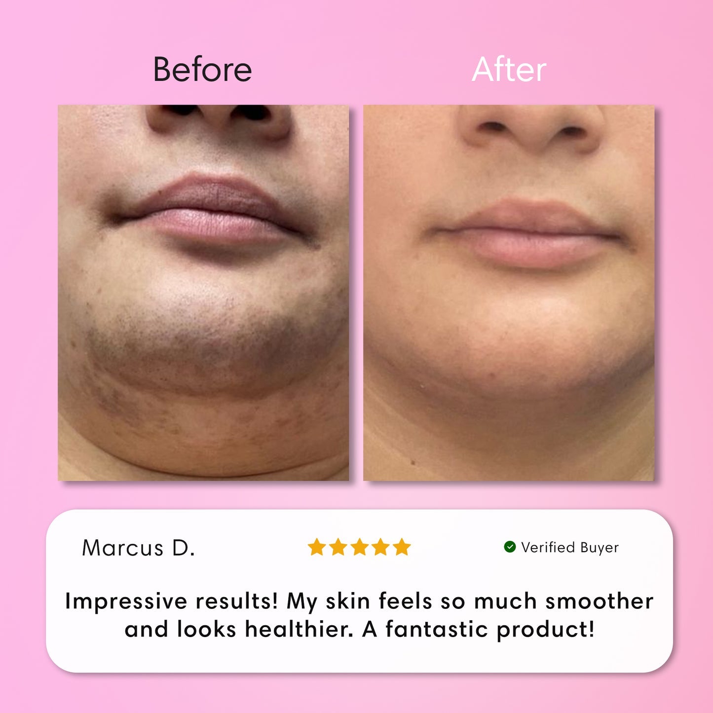 ✨[Official Store]✨                  𝑨𝑸𝑨™ 𝑰𝒏𝒔𝒕𝒂𝒏𝒕 𝑯𝒂𝒊𝒓 𝑹𝒆𝒎𝒐𝒗𝒂𝒍 𝑲𝒊𝒕
