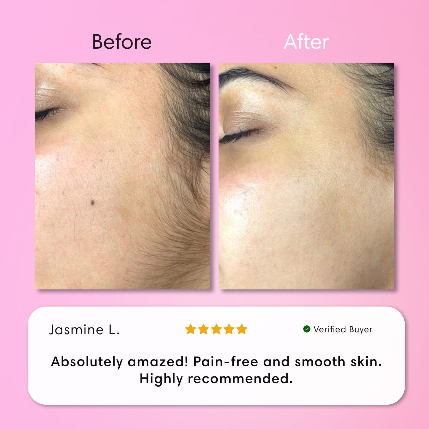 ✨[Official Store]✨                  𝑨𝑸𝑨™ 𝑰𝒏𝒔𝒕𝒂𝒏𝒕 𝑯𝒂𝒊𝒓 𝑹𝒆𝒎𝒐𝒗𝒂𝒍 𝑲𝒊𝒕