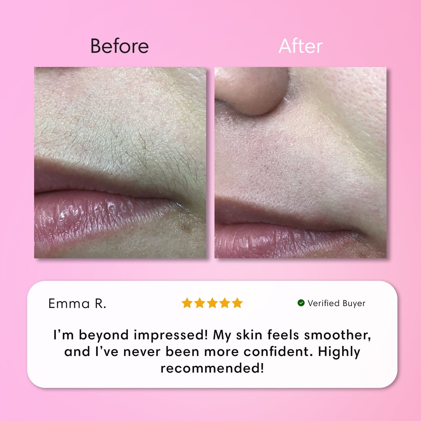 ✨[Official Store]✨                  𝑨𝑸𝑨™ 𝑰𝒏𝒔𝒕𝒂𝒏𝒕 𝑯𝒂𝒊𝒓 𝑹𝒆𝒎𝒐𝒗𝒂𝒍 𝑲𝒊𝒕