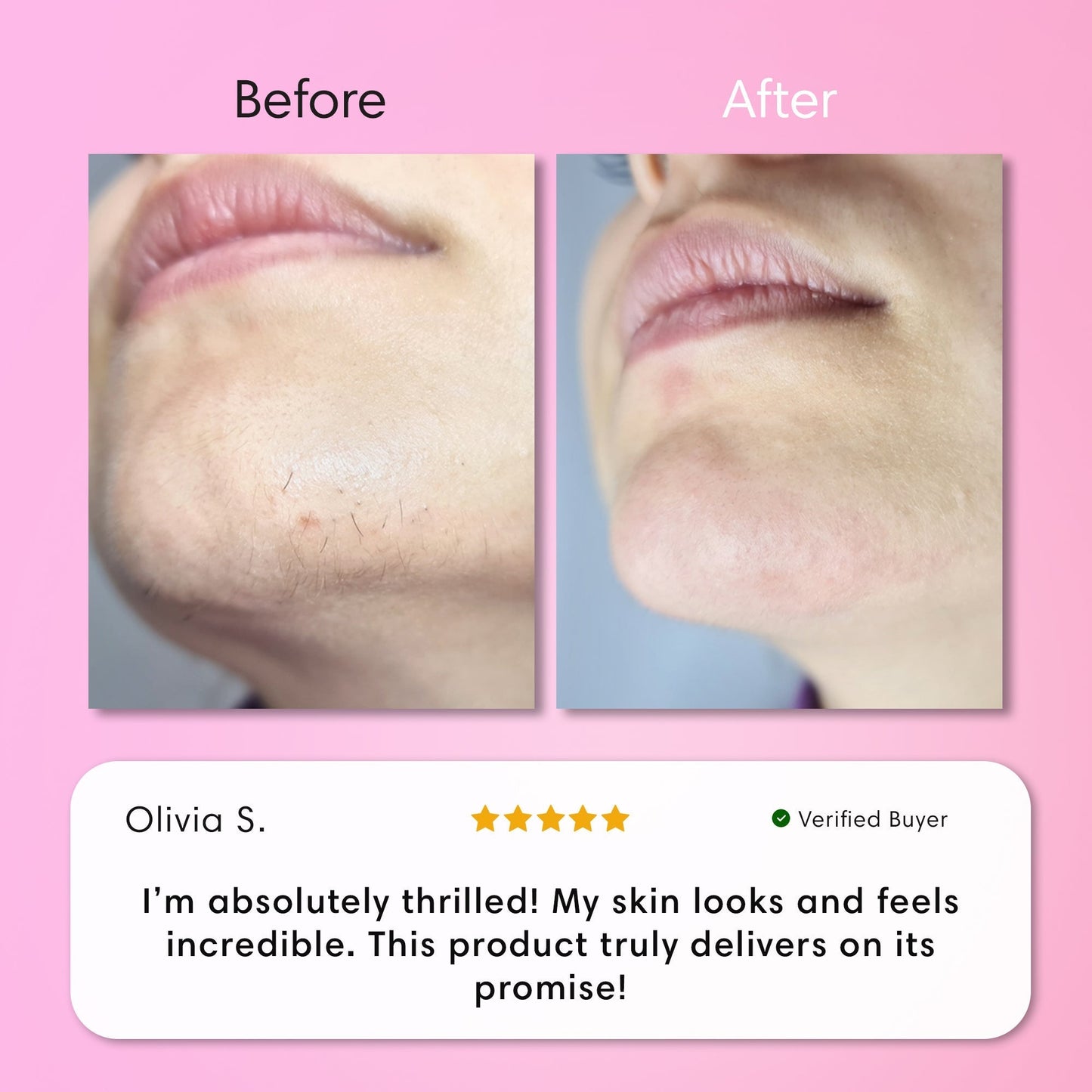 ✨[Official Store]✨                  𝑨𝑸𝑨™ 𝑰𝒏𝒔𝒕𝒂𝒏𝒕 𝑯𝒂𝒊𝒓 𝑹𝒆𝒎𝒐𝒗𝒂𝒍 𝑲𝒊𝒕