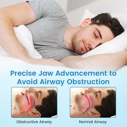 ✨QIAWI™ Anti-Snoring & Teeth Grinding Mouthpiece